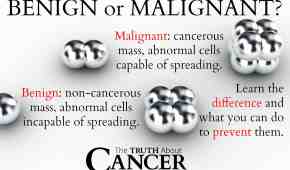 Benign and Malignant Tumors