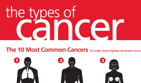 Common Types of Cancer