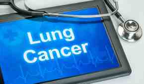 Lung Cancer